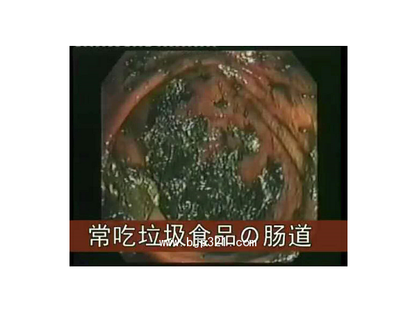藤黃果