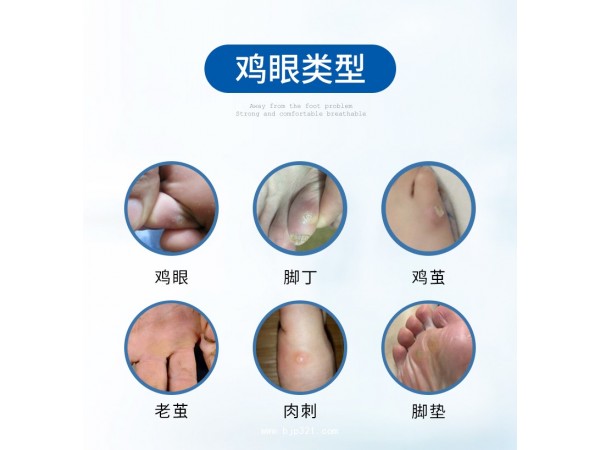 元榮冷敷貼雞眼貼瘊子肉刺貼