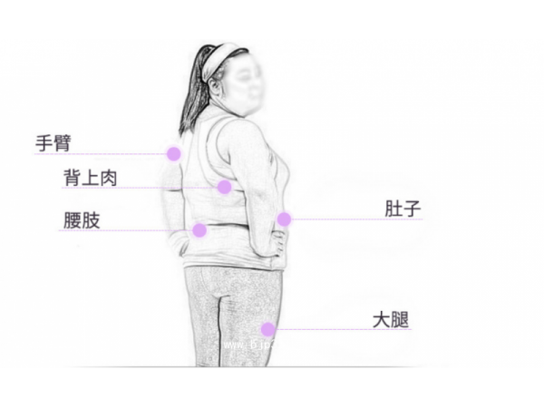王氏奇牌輕姿貼 懶人貼