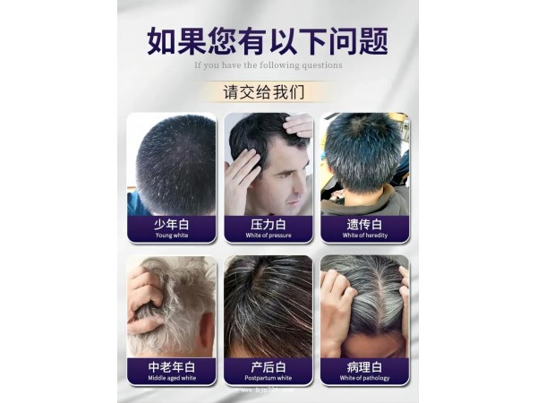 AIDEVI? 刺梨 復(fù)合片 （養(yǎng)發(fā)新生，重回黑發(fā)）火爆招商中