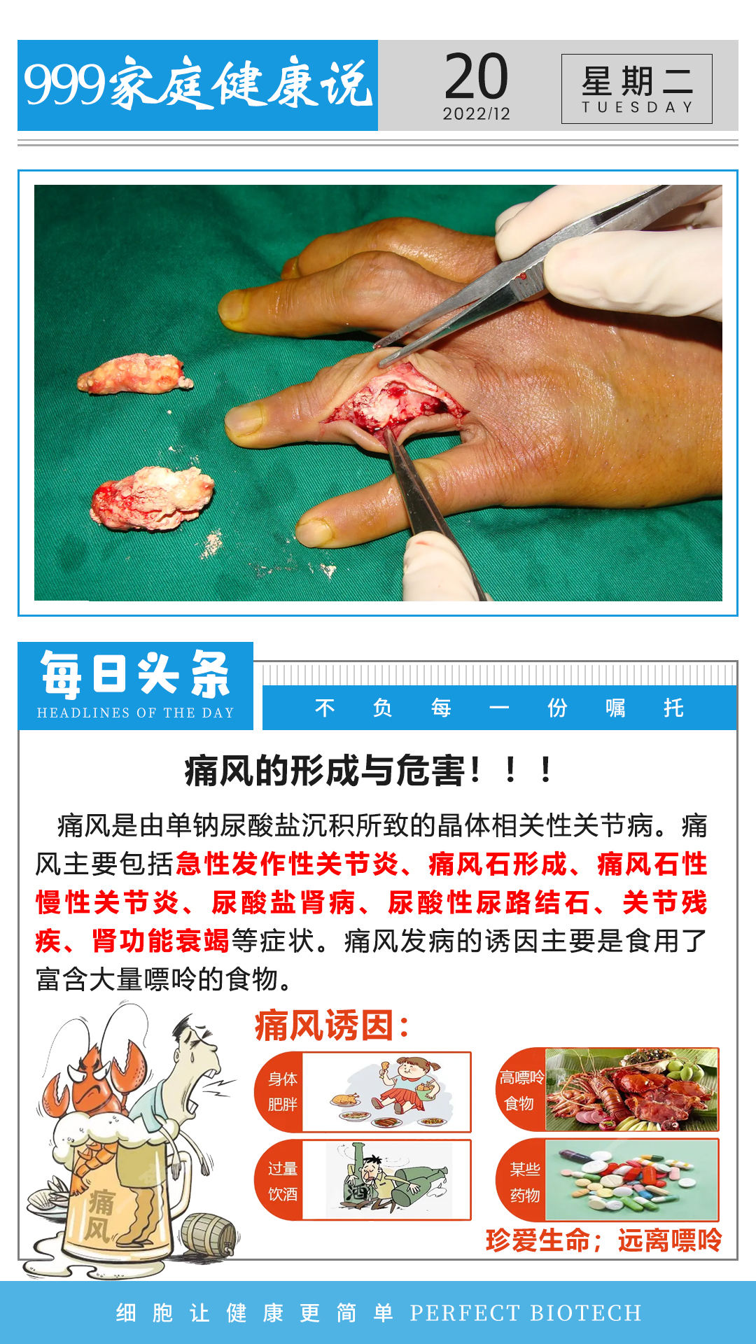 1220痛風(fēng).jpg